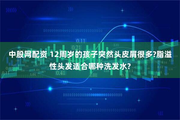 中股网配资 12周岁的孩子突然头皮屑很多?脂溢性头发适合哪种洗发水?